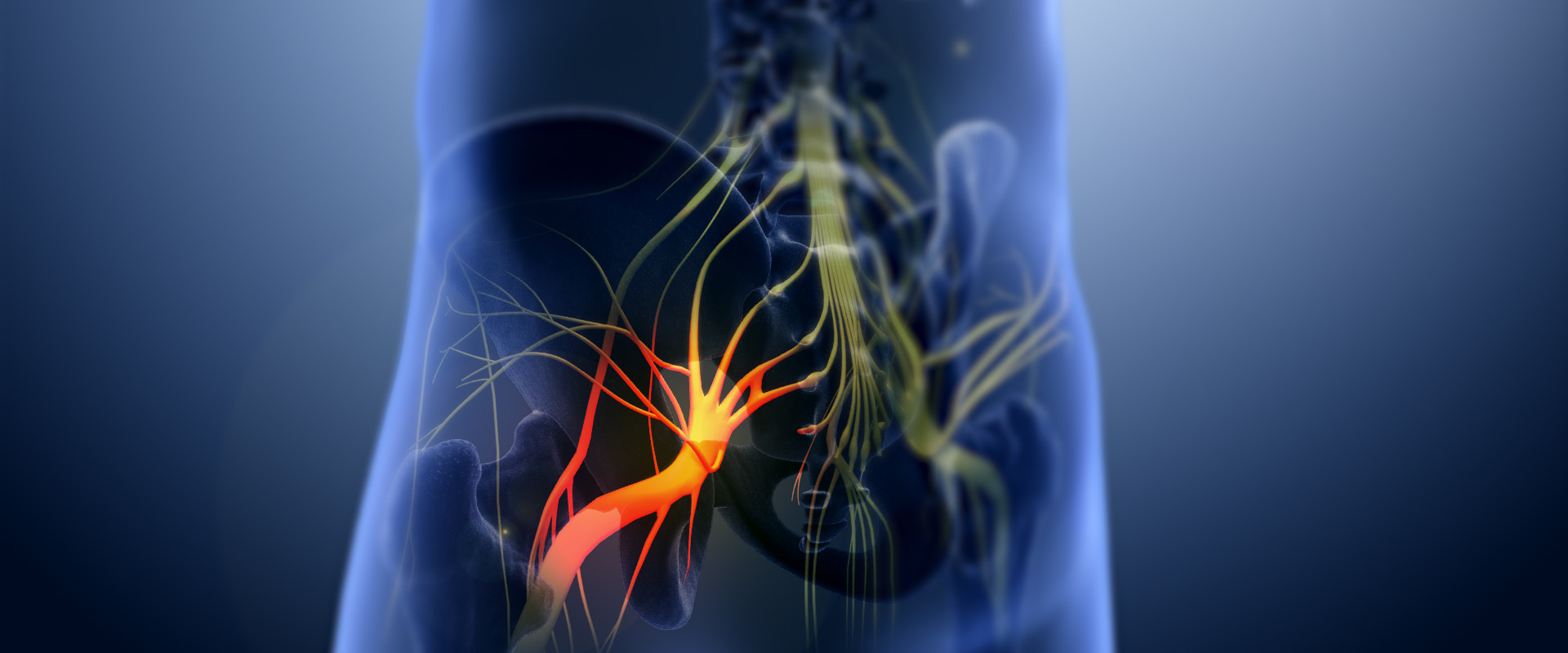 Can Cannabis Help Relieve Sciatic Nerve Pain?