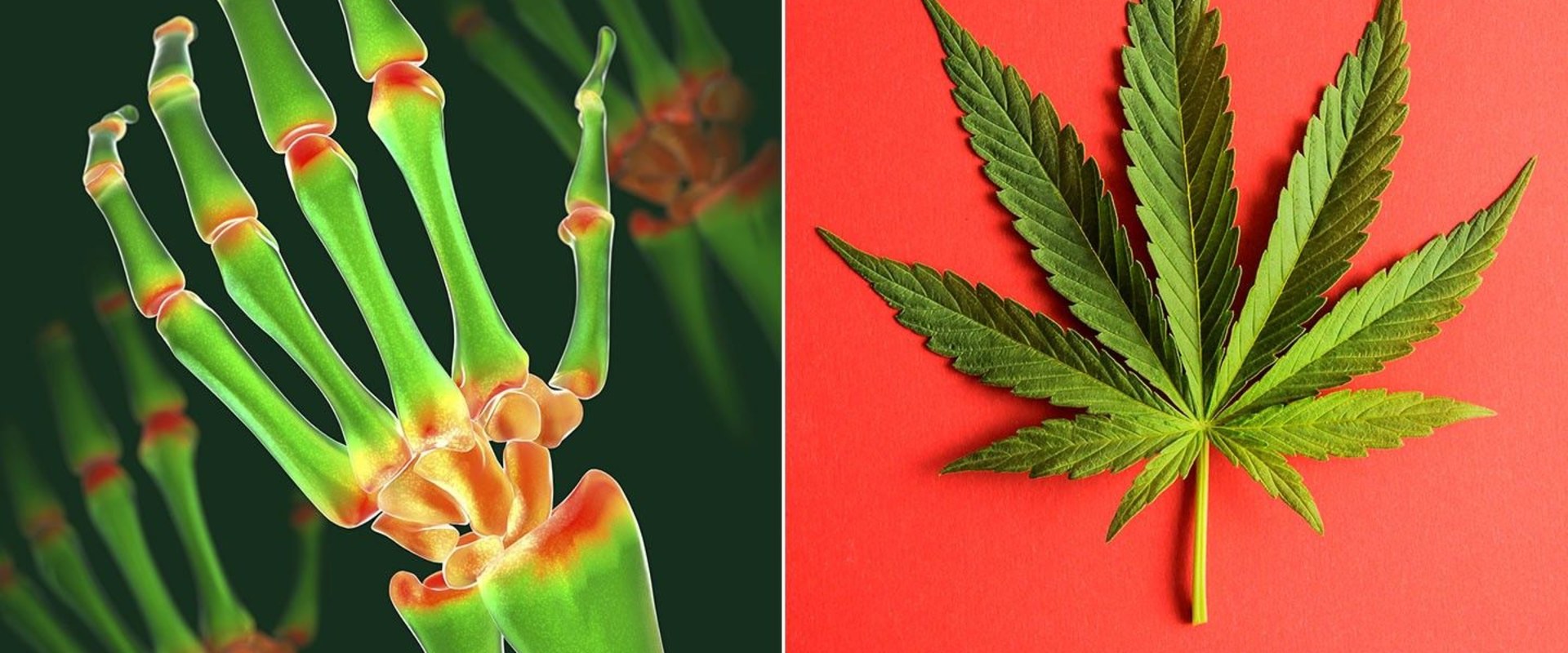 Cannabis for Arthritis: How Much THC is Needed?