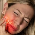 Can CBD Oil Help with Tooth Pain?